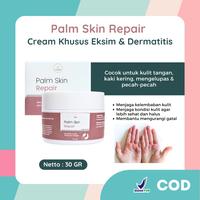 Gambar Leika Skincare Palm Skin Repair Cream Khusus Eksim Dermatitis Kulit Kering Mengelupas Telapak Kaki Kering Kulit Gatal Eksim Menghaluskan Kulit Kaki Dan Tangan Hand Perawatan Kulit Gatal Kulit Tangan Kasar Berminyak Mencerahkan dari Dinifaa Beauty Store Kota Cirebon 1 Tokopedia