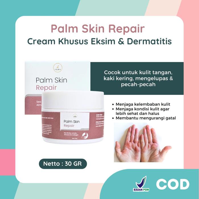 Gambar Leika Skincare Palm Skin Repair Cream Khusus Eksim Dermatitis Kulit Kering Mengelupas Telapak Kaki Kering Kulit Gatal Eksim Menghaluskan Kulit Kaki Dan Tangan Hand Perawatan Kulit Gatal Kulit Tangan Kasar Berminyak Mencerahkan dari Dinifaa Beauty Store Kota Cirebon Tokopedia
