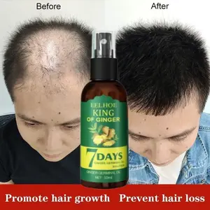 EELHOE 7 Days Minyak Penumbuh Rambut Botak Rontok dan Perawatan Rambut 30ml - Korea Ginger Germinal Oil Serum Anti Rontok