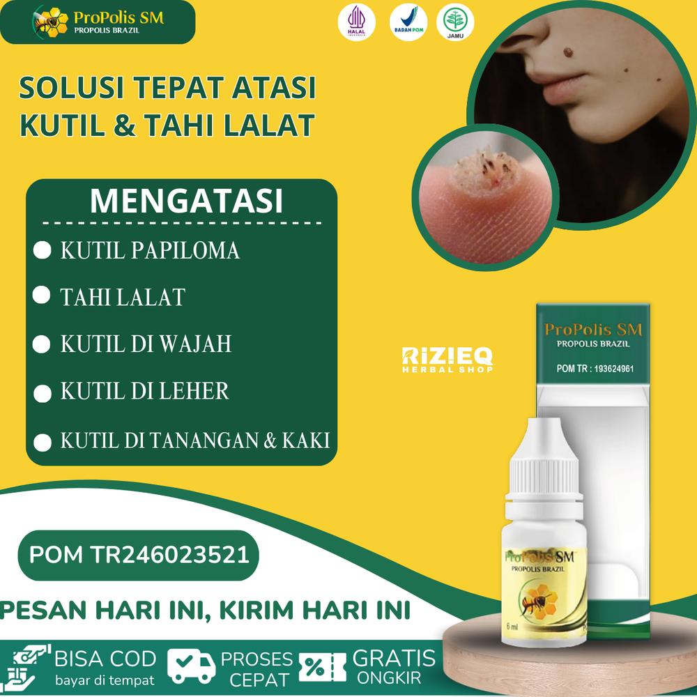 Penghilang Kutil Papiloma dan Tahi Lalat, Kutil di Wajah, Kutil di leher, Kutil di Tangan dan Kaki dengan Propolis SM Isi 6ml