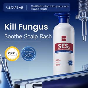 ClearLab Shampoo Syampu Selenium Sulfide, ClearLab, untuk Kegunaan Keluarga, Melegakan Gatal, Mengawal kelemumur, Mengawal Minyak, Menambah Isipadu