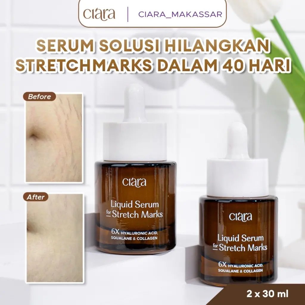 2Botol Ciara Liquid Serum For Stretchmarks Ibu Hamil cream irit penghilang stretch mark