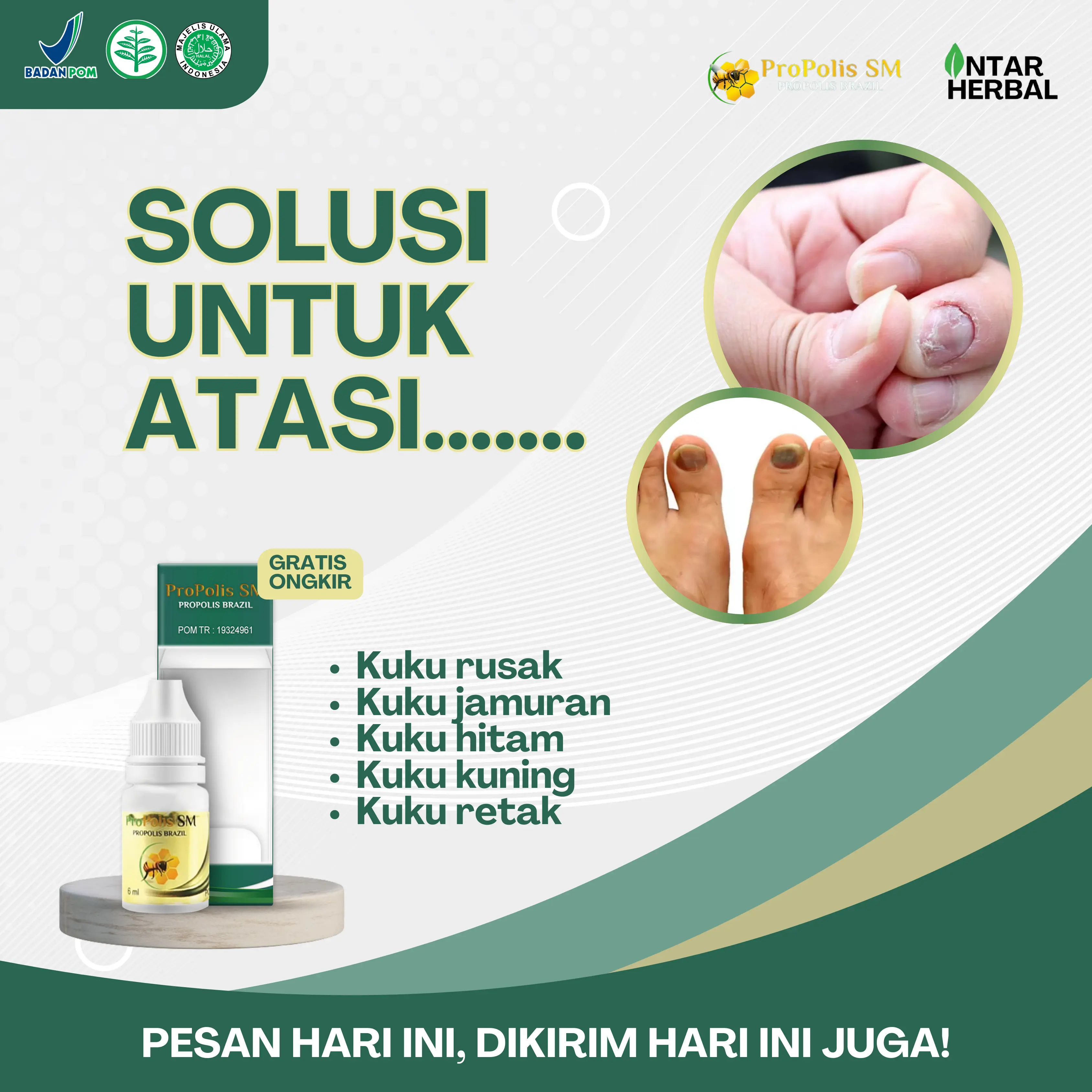 Propolis SM Kuku Rusak Untuk Atasi Kuku Berjamur, Penghilang Jamur Kuku, Kuku Retak Pecah, Kuku Bergaris, Psoriasis Kuku, Kuku Kering, Kuku Kuning Dan Hitam, Vitamin Kuku Nail