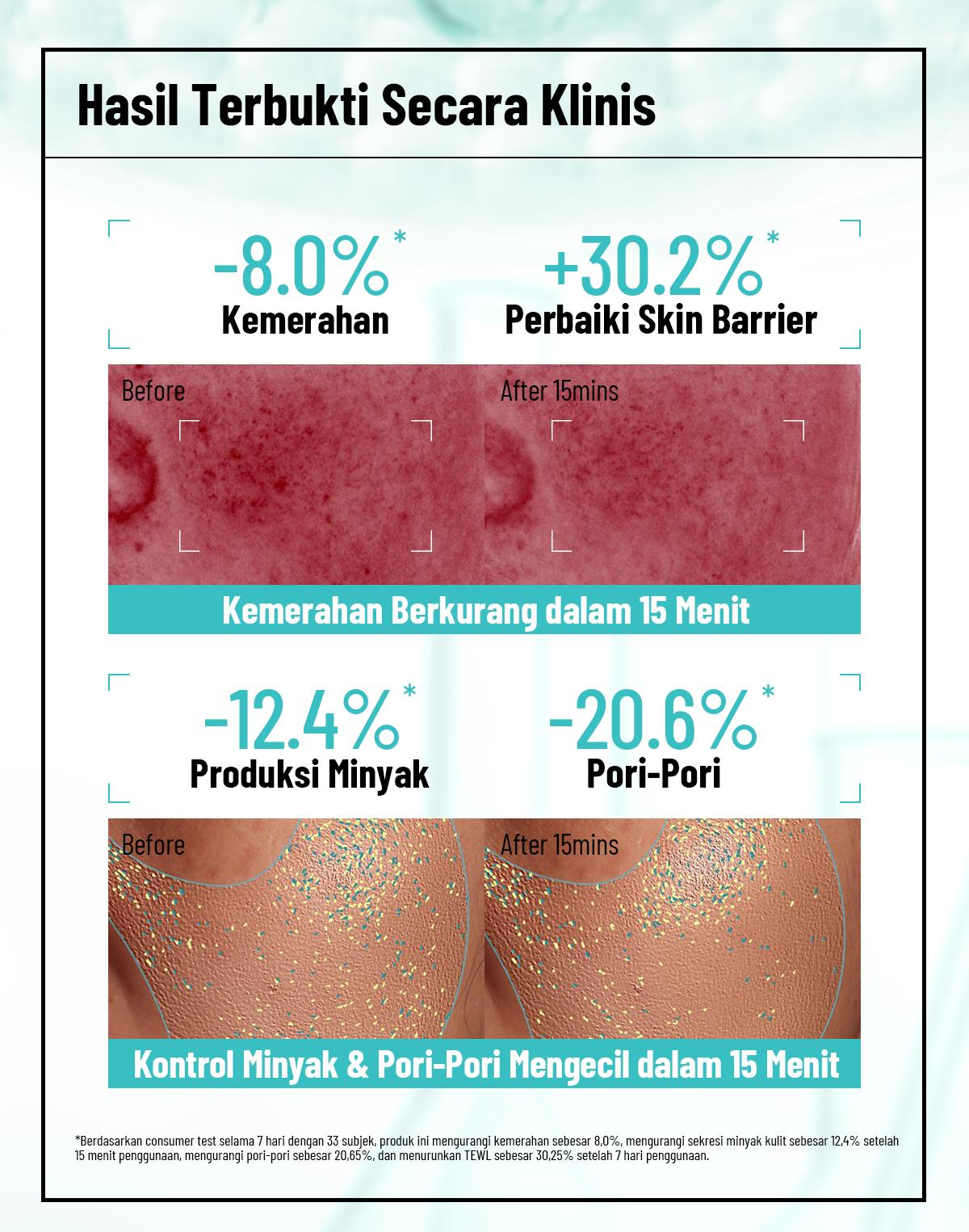 Formulogic: B3-Ceramide Oil-Control Barrier Moisturizer 40 ML | Kontrol Minyak & Perkuat Skin Barrier cream Formulogic: B3-Ceramide Oil-Control Barrier Moisturizer 40 ML | Kontrol Minyak & Perkuat Skin Barrier cream