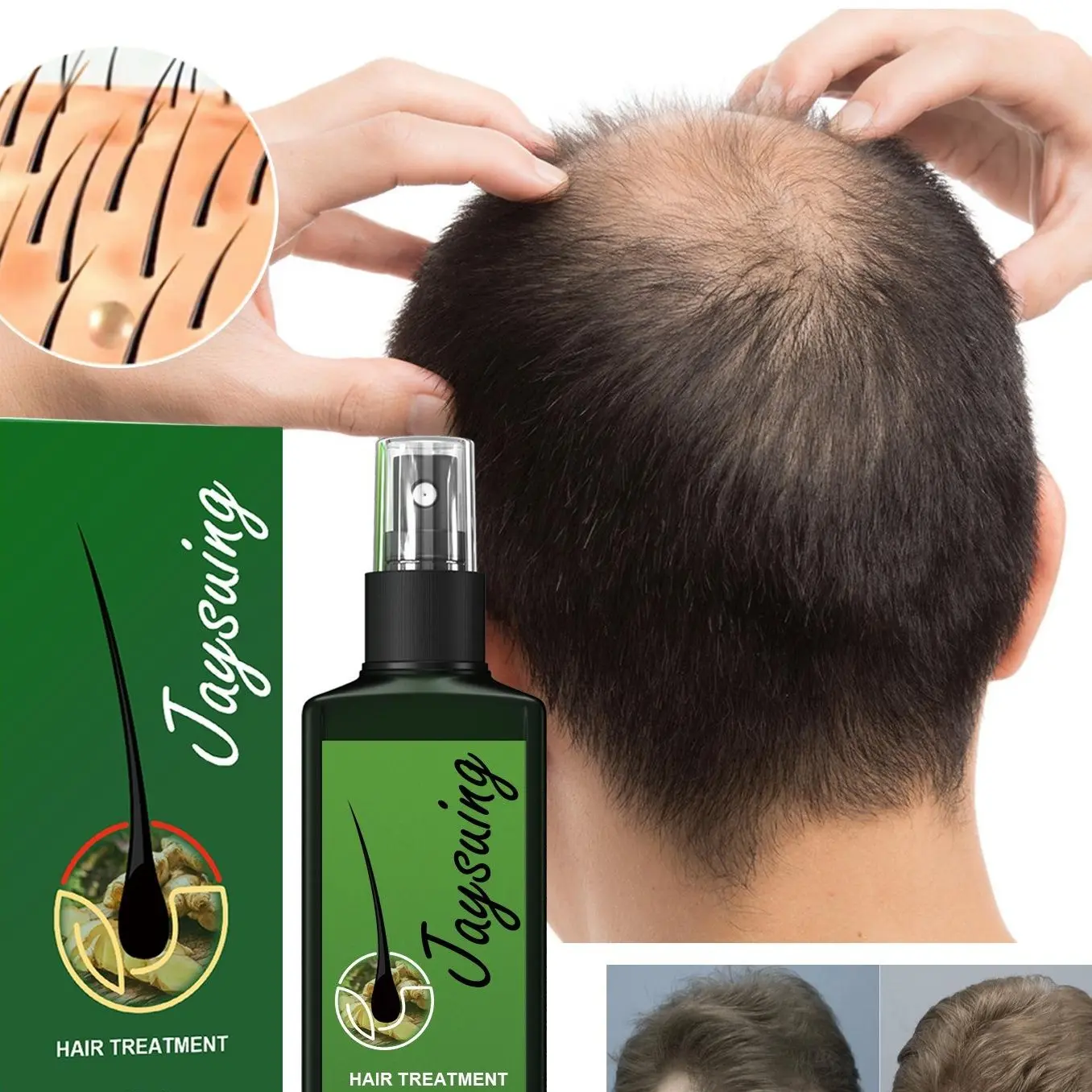 jaysuing ginger hair growth spray penumbuh rambut cepat serum penumbuh rambut botak hair tonic rambut rontok 30ml Kering Perawatan