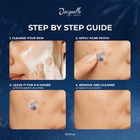 Gambar Jacquelle Premium Hydrocolloid Acne Patch x Zootopia 2 Edition dari Jacquelle_ID Kota Administrasi Jakarta Selatan 4 Tokopedia