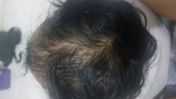 Product Review of Rish' Minyak Kemiri 120ml from G**n 3