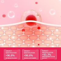 Gambar Drve salicylic acid acne serum | anti acne skincare 10ml | Membantu mengatasi kulit berjerawat kemerahan dan bekas jerawat - 1Pcs dari Drve beauty skin 6 Kab. Tangerang 4 Tokopedia