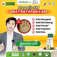 Gambar Propolis SM Obat Rayapan Kaki Bau - 6ml - Foot, Gatal Perawatan dari HerbalZen Kota Administrasi Jakarta Pusat 1 Tokopedia
