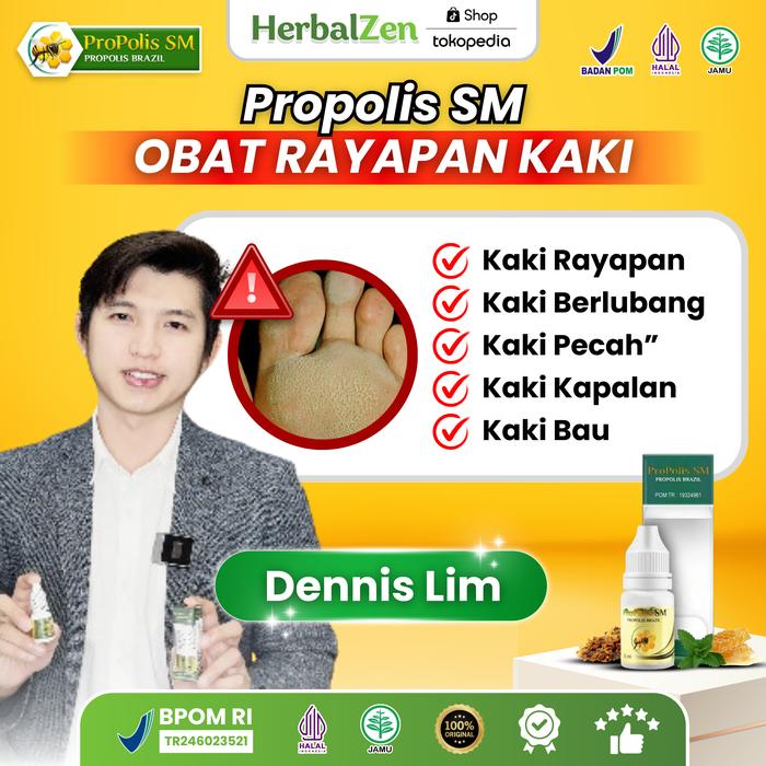 Gambar Propolis SM Obat Rayapan Kaki Bau - 6ml - Foot, Gatal Perawatan dari HerbalZen Kota Administrasi Jakarta Pusat Tokopedia