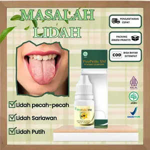 Obat Untuk Masalah Lidah, Lidah Sariawan, Benjolan Di Lidah & Luka Di Lidah, Lidah Terasa Perih-Propolis SM