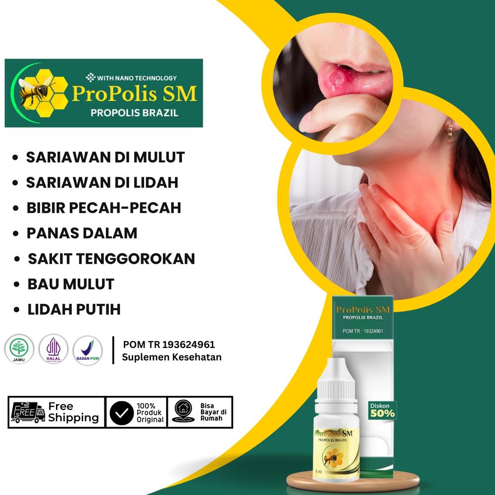 Propolis Sm Atasi Sariawan Mulut Lidah Panas Dalam Bibir Pecah-Pecah Menahun Anak Dan Dewasa