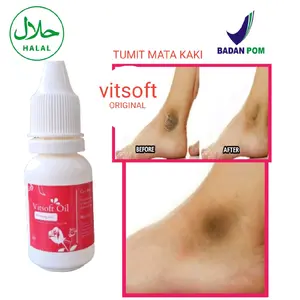 VITSOFT PEMUTIH TUMIT PADA MATA KAKI Dengkul dan sikut tangan