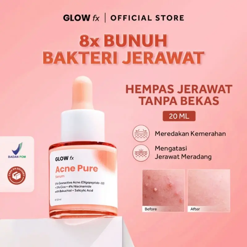 (SPESIAL LIVE) GLOW FX Beauty Glow Bomb Serum Acne Pure Serum 19% Brightening Power 20ml Tetes Wajah 2