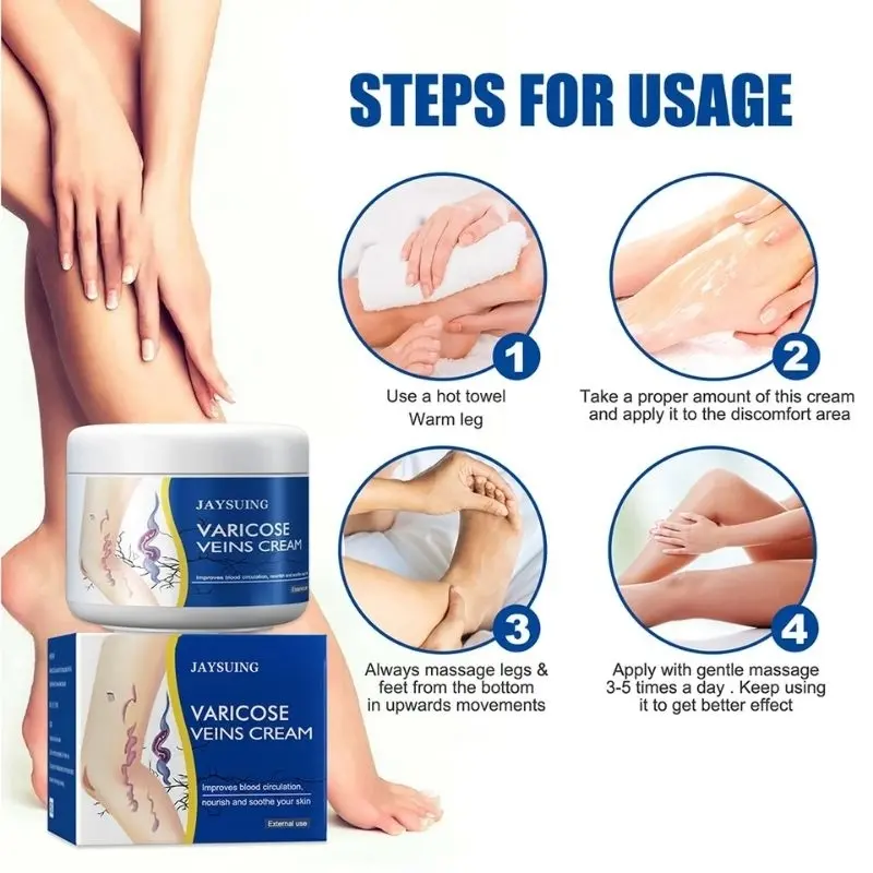 Jaysuing Varicose Veins Cream Membantu Meingkatkan Sirkulasi Darah Dan Menghilangkan Varises 2