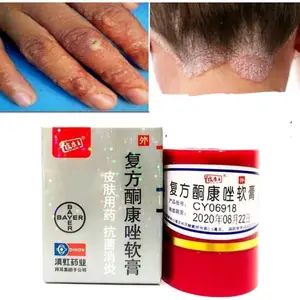 SALEP KULIT PI KANG WANG MENGATASI JERAWAT GATAL JAMUR PANU KURAP EKSIM MENYAMARKAN NODA HITAM DIKULIT Wajah Berjerawat Bopeng Kering Muka Perawatan Aging Treatment Berminyak Kusam Kering - Produk Perawatan Kulit untuk Kulit Kering dan Berminyak