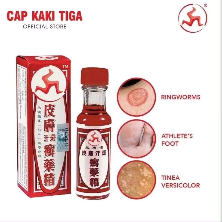 Ubat Kurap Cap Kaki Tiga Tinner 12ml - Salicylic Acid, Benzoic - TikTok ...
