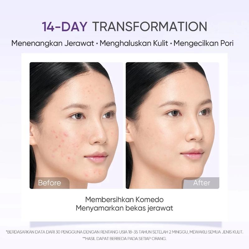 Product Introduction of SKINTIFIC Lactic Acid Skin Renewal Exfoliating Serum muka 20ml Gentle Acne Treatment Pore-Tightening 26