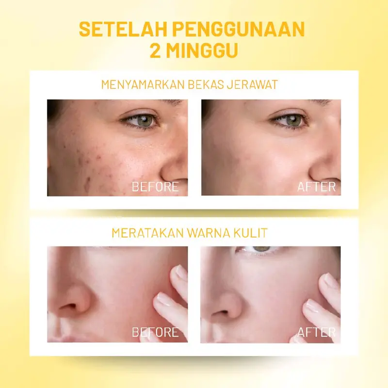 [PAKET BUNDLING] BEAUPHORA - Day Cream 30gr & Night Cream 30gr untuk Kulit Cerah 7 Hari, Anti-Aging, Melembapkan, BPOM NA18240115255 6