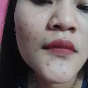 [ 3 BOX ] L-Pink Capsule Glawfyskin | Capsule Kesehatan Kulit | Membantu memelihara kesehatan kulit | BPOM