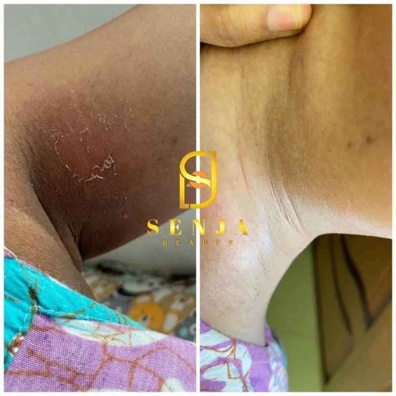 Senjalux Cream Lipatan Senjalux Whitening Underarm With Niacinamide 15gr Mencerahkan Ketiak Leher Siku Lutut Mata Kaki dll BPOM NA18241904039 Pencerah Tubuh
