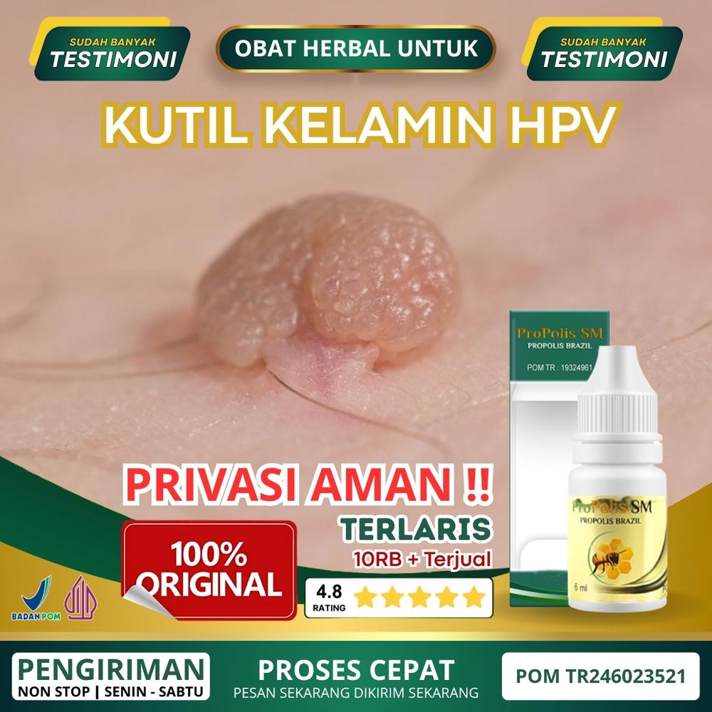 ProPolis SM Herbal Kutil Kelamin HPV, Perontok Kutil Kelamin, Penghilang Kutil Kelamin, Jengger Ayam, Jamur Kelamin, Kutil di Kelamin, Merontokan Kutil Kelamin, Penghancur Kutil Kelamin, Menghilangkan