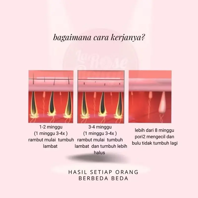 IPL ALAT PENGHILANG BULU PERMANEN / IPL HAIR REMOVAL 4