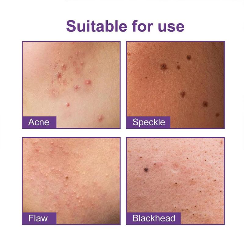 Product Introduction of 180pcs/box Hydrocolloid Acne Patch Pimple Repair Patch Ance Colorful Starry Care Face Sky L7K7 34