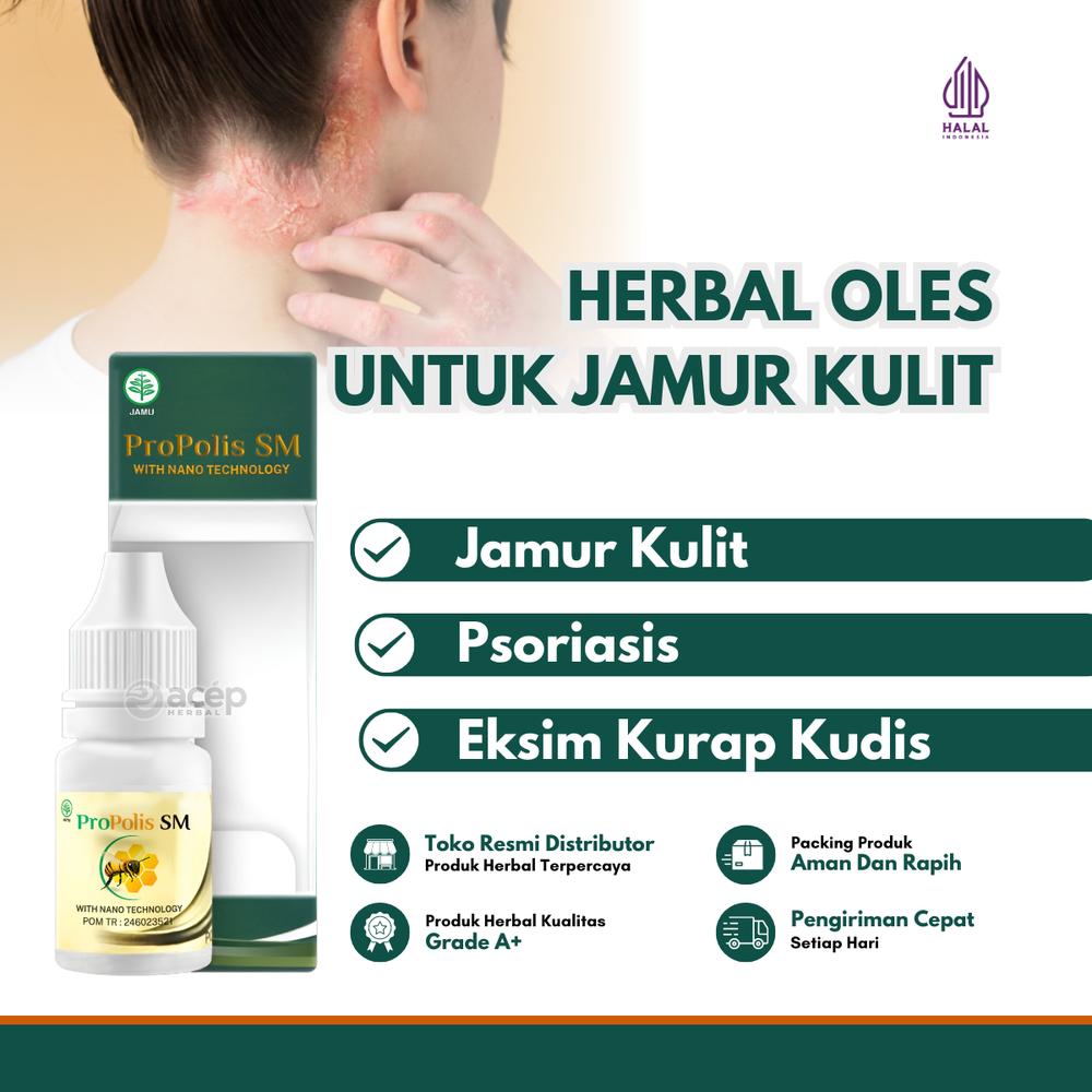 Propolis Sm - Membantu Keluhan Kulit Jamur Psoriasis Eksim Kurap Kudis Isi 6 ml Bpom Halal Mui