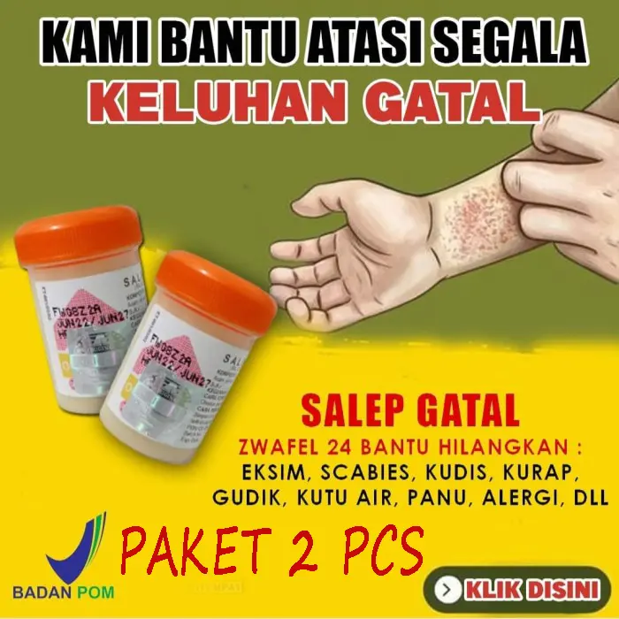 Paket 2PCS salep belerang Zwafel24 BPOM - mengatasi panu kadas kurap eksim alergi kutu air dan jamur