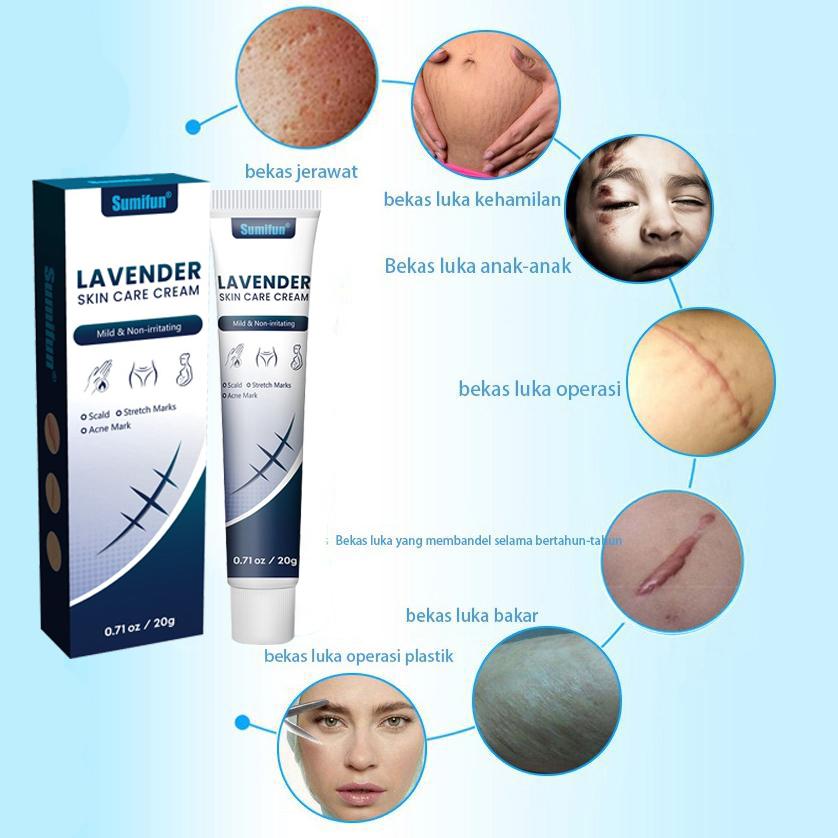 Original Import Cream Penghilang Bekas Luka Krim Ampuh PenghilangJerawat Bekas Cacar Gatal Koreng Gigitan Nyamuk Serangga Luka Air Panas Knalpot Perawatan Penghilang Bekas Luka Stretch Mark Keloid Cream Salep Luka Bakar Lama Jerawat Koreng