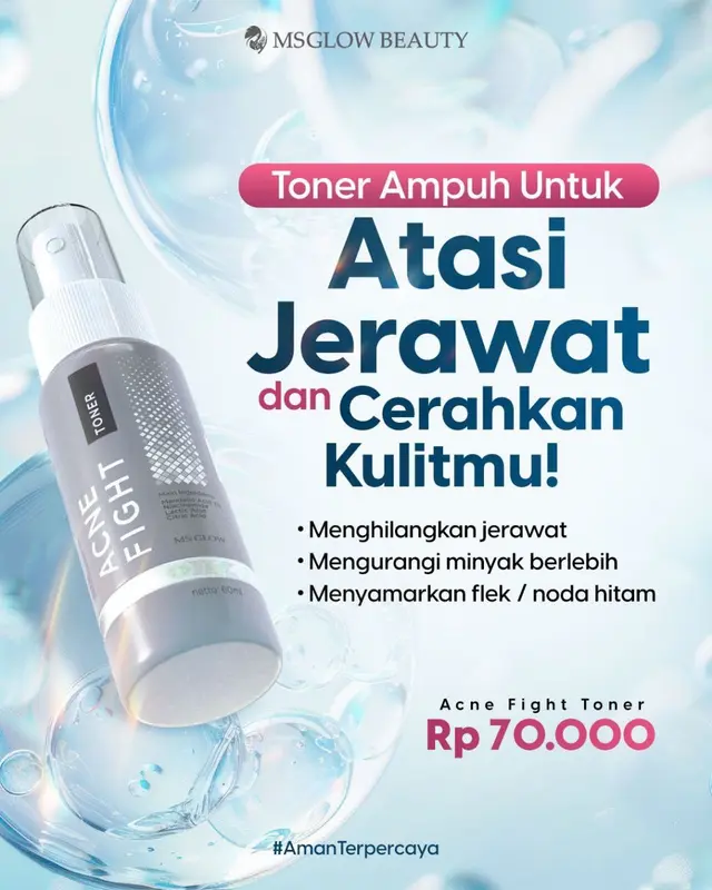 MS GLOW ACNE FIGHT TONER 60ML 5