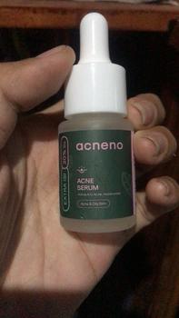Product Review of [ORI] Serum Perawatan Muka Berjerawat Bruntusan - Acneno Isi 12 ml | Bantu Atasi Wajah Bruntusan Berminyak Kusam Mengandung Niacinamide | BPOM Original from i**i 0