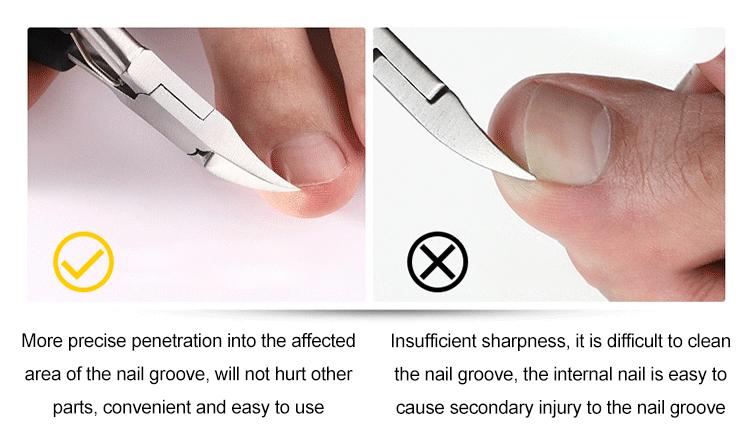 Product Introduction of Nail clippers for ingrown toenails single hawkbill clippers for gray fingernails nail fissures 4