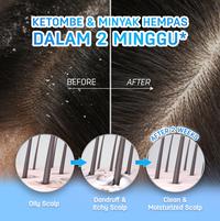 Gambar ERHAIR Scalperfect Exfoliating Gel 65gr - Gel Anti Ketombe dari ERHAIR Store Kota Administrasi Jakarta Barat 3 Tokopedia