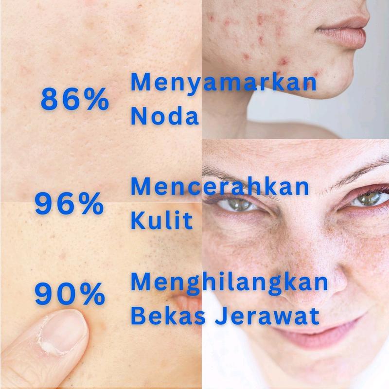 dr be dark spot/serum perawatan wajah/AMPOULE SERUM MENCERAHKAN/SERUM FORMULASI DOKTER Essence Pencerah Kusam 3