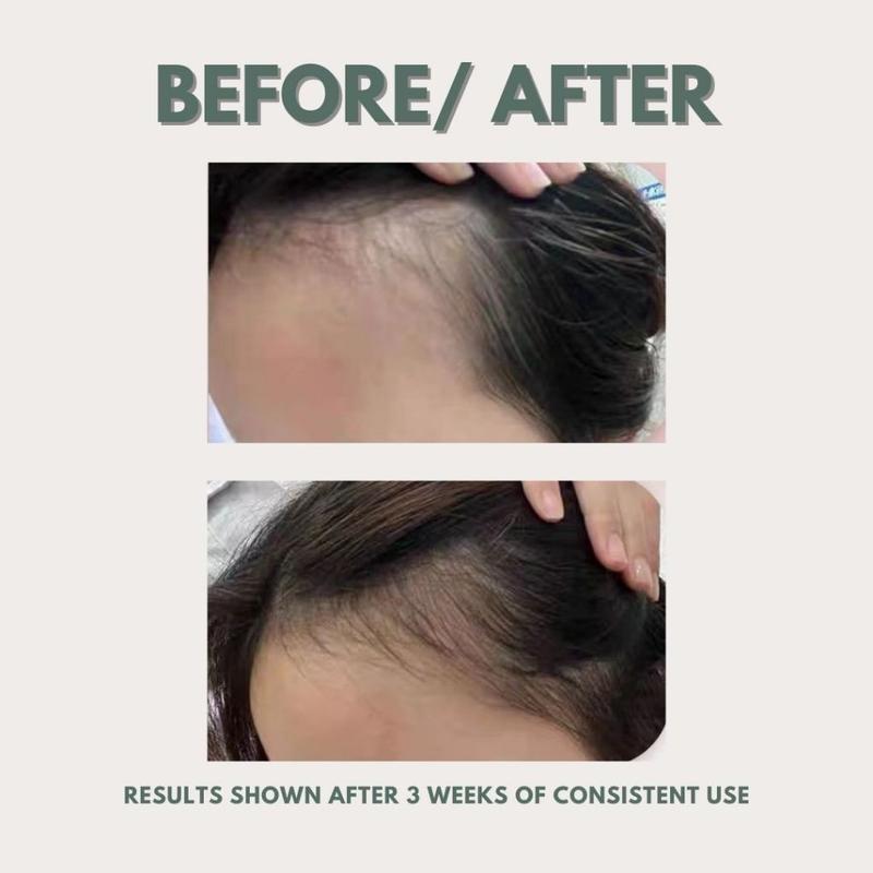 [MadeToBloom] Roots Revival Herbal Hair Growth Essence 2