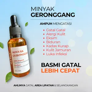 ArbaPlus Minyak Geronggang Anti-Gatal dan Anti-Iritasi Alami untuk Kulit Sehat solusi herbal Meredakan gatal secara efektif Tetes Perawatan Tetes Perawatan Leher Tubuh Kering Tangan Hitam Mengencangkan Ketiak