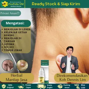 Propolis - Obat kelenjar getah bening, Benjolan di leher,Tumor jikak, Lipoma, Uci uci, benjolan di tangan, benjolan di seluruh tubuh