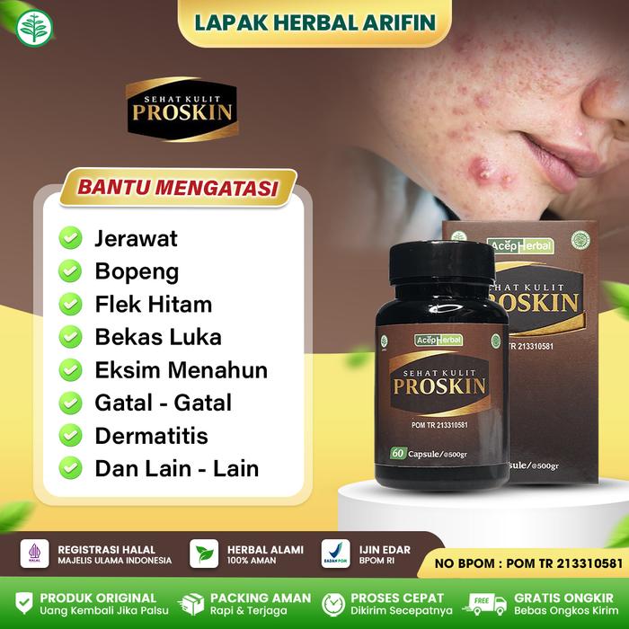 Gambar Untuk Jerawatan Flek Hitam - Bopeng Bekas Jerawat - Proskin Kapsul Vitamin Gatal dari Lapak Herbal Arifin Kota Administrasi Jakarta Barat Tokopedia