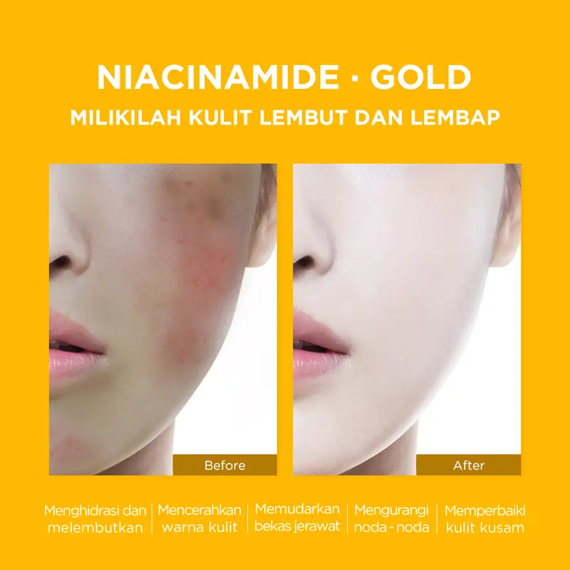 INTOFACE 24K Gold Ginseng Anti Aging Serum Brightens Spot light Anti-age 24K Gold Ginseng Niacinamide Mencerahkan Wajah Essence Muka Tetes Mengencangkan 6