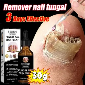 EELHOE Serum Perawatan Jamur Kuku Anti-Jamur, Anti-Infeksi Solusi Kuat untuk Masalah Jamur Kuku 30ml