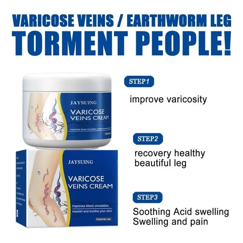 Jaysuing Varicose Veins Cream Membantu Meingkatkan Sirkulasi Darah Dan Menghilangkan Varises 1