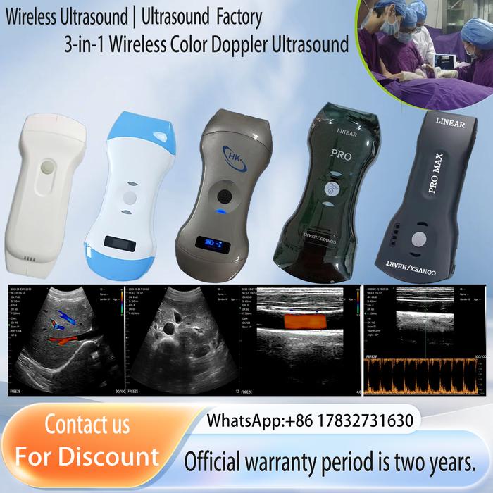 Jual Portable Wireless 3in1 Color Doppler Ultrasound Scanner WiFi ...