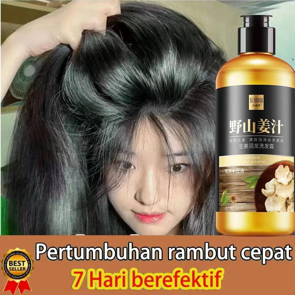 Shampo Penumbuh Rambut Cepat Ginger Shampoo 300ml Anti Rontok & Anti Ketombe Kontrol Minyak Nutrisi Rambut Perawatan Rambut Hair Care Shampo Penumbuh Rambut Cepat Ginger Shampoo 300ml Anti Rontok & Anti Ketombe Kontrol Minyak Nutrisi Rambut Perawatan Rambut Hair Care
