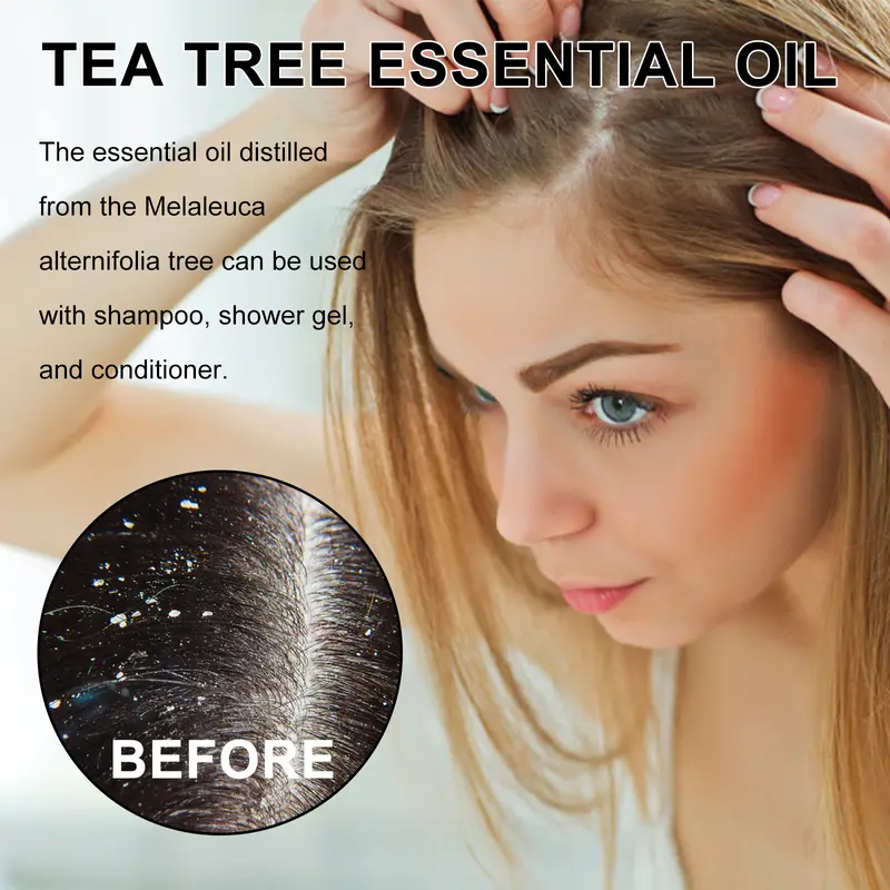 Tea Tree Oil memperbaiki rambut, melembabkan kulit wajah, menghidrasi dan memperbaiki jamur kuku Perawatan Teh Tetes Essence Kering Memutihkan Melembutkan Berminyak Memudarkan Muka 2