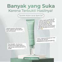 Gambar [Promo] Reglow Acne Spot Gel | Obat Totol Jerawat Cepat Kering | Redakan Kemerdehan, Bekas Jerawat & Bikin Kulit Lebih Halus Tanpa Iritasi dari Reglow Beauty Skin Id Kab. Bantul 5 Tokopedia