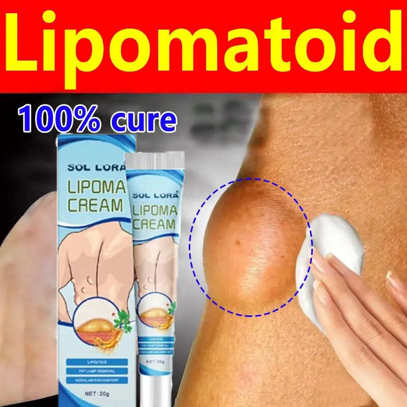 Medicine lump lipoma 20g lipoma cream ointment lump cream lump on the neck of the hands armpit bumps on the neck back shoulder feet