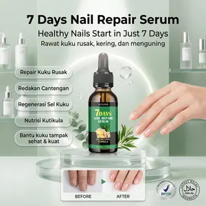 [ FREE ONGKIR ] Serum Kuku 7 Days – Redakan Cantengan & Perbaiki Kuku Rusak – Anti Bakteri, Cocok untuk Cantengan & Kuku Sensitif
