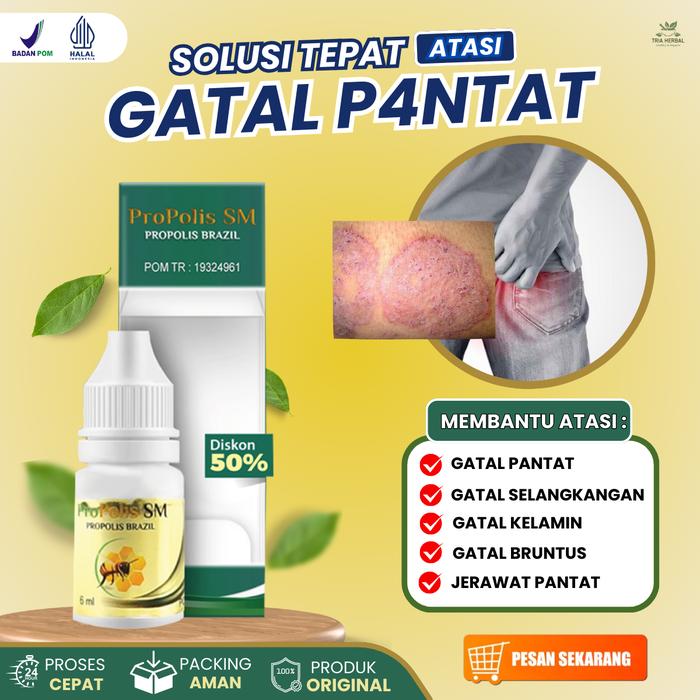 Gambar Salep Cair Propolis SM - Perawatan Gatal Bruntusan dan Berjerawat di Pantat serta Selangkangan - Bopeng Koreng di Pantat dari Tria Herbal Store Kota Administrasi Jakarta Barat Tokopedia